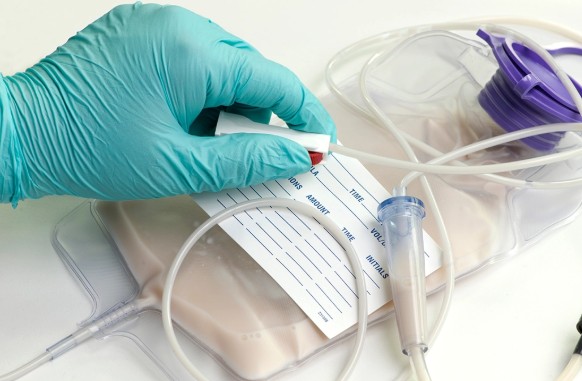 nutrition parentérale